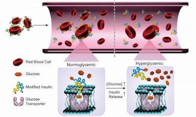 智能胰岛素降糖系统将使糖尿病治疗取得突破