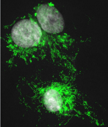 细胞治疗用于癌症免疫治疗