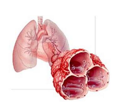 肺纤维化治疗——肺纤维化都有哪些症状