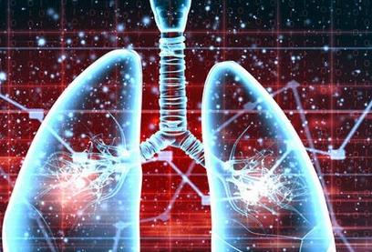 肺纤维化治疗——肺纤维化早期症状有哪些呢