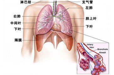 肺纤维化治疗——肺纤维化的危害与预防