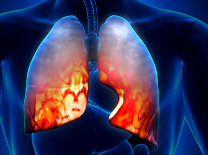 肺纤维化治疗--肺纤维化的病因中哪些较为常见