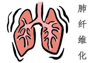 肺纤维化治疗——什么是肺纤维化疾病