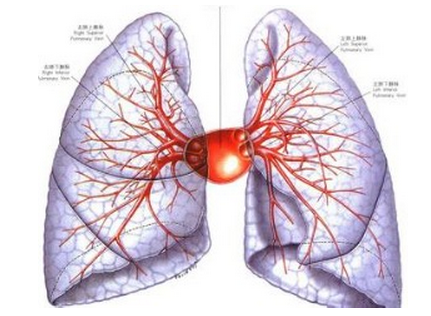 肺纤维化治疗——常见引起肺纤维化的病因有哪些
