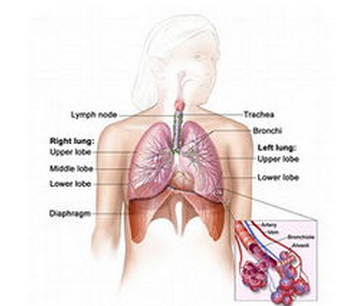 肺纤维化治疗——肺纤维化的护理方法