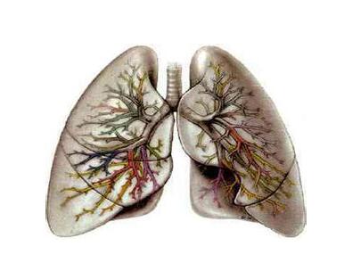 肺纤维化治疗——中年肺纤维化症状有哪些
