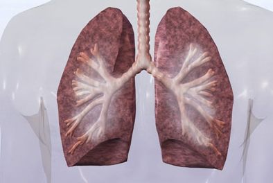 肺纤维化治疗——肺纤维化的致病因素有哪些