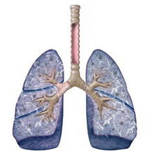 肺纤维化治疗——什么是特发性肺纤维化